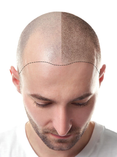 contact-hairline-solutions