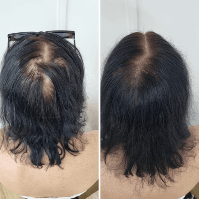 SMP Thickening before afters (10)