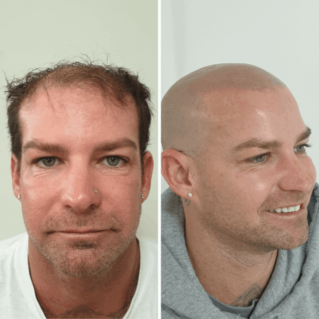 SMP before afters (17)