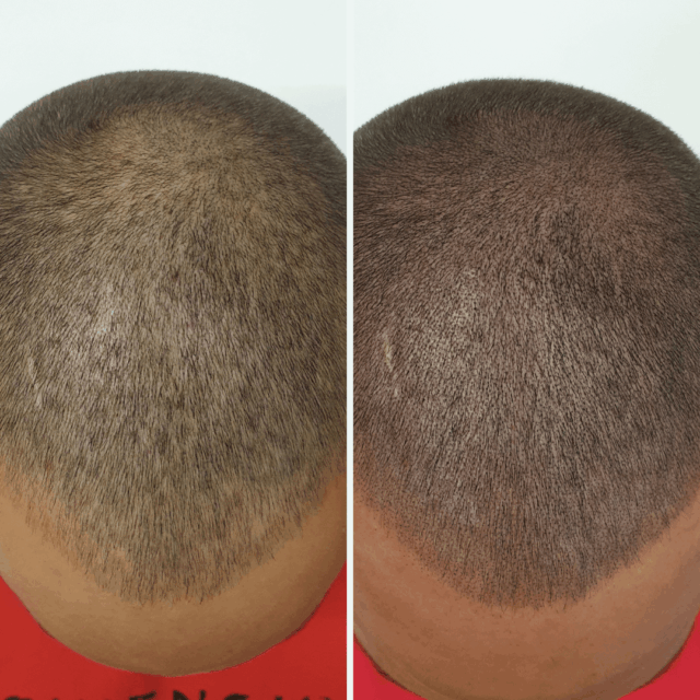 SMP before afters (18)