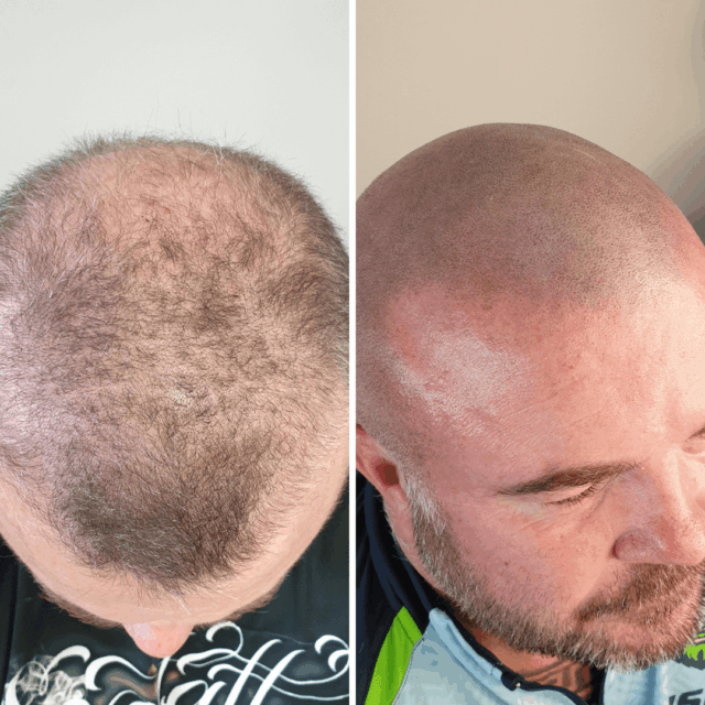 SMP before afters (21)