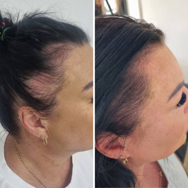 scalp micropigmentation pre-care women
